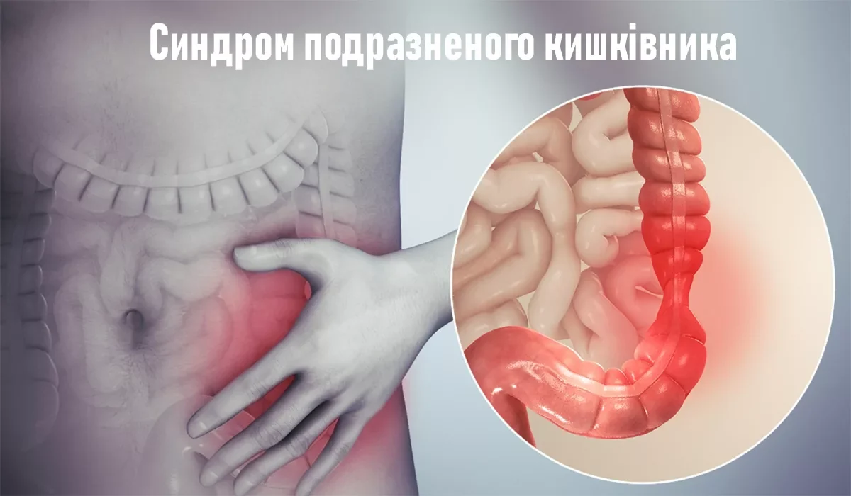 Медична ілюстрація живота з рукою та виділеними кишками поруч зі збільшеною товстою кишкою